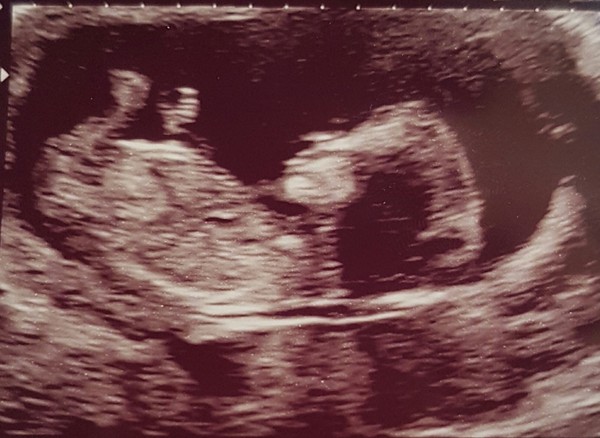 Boy or girl guesses please!!