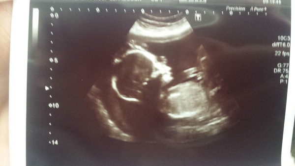 Staying posifrickentive- Thread 15 for ladies pg after mc