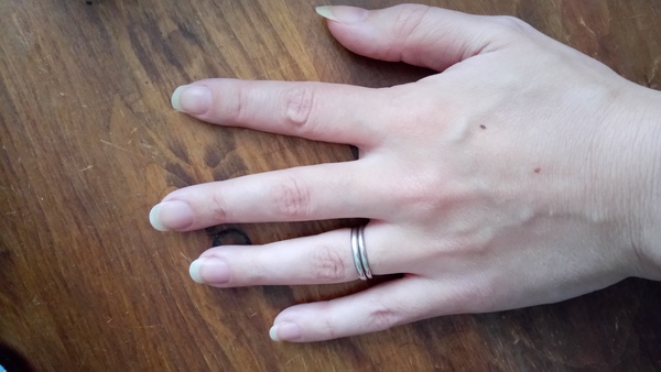 Guess the age of my hand.