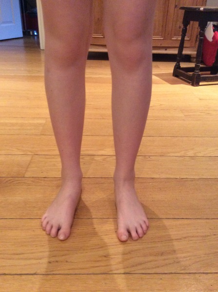 Feet question!