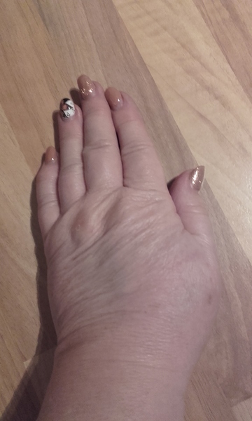Guess the age of my hand.