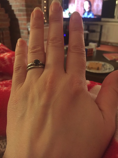 Guess the age of my hand.