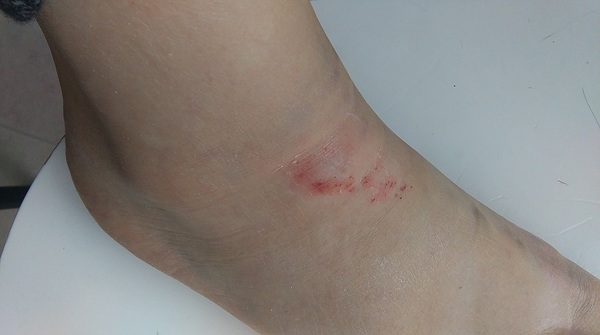 To wonder if this needs an GP examination / x-ray?  (Photo)