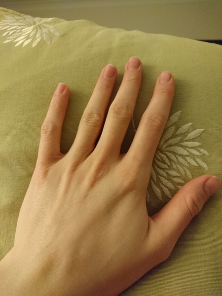 Guess the age of my hand.