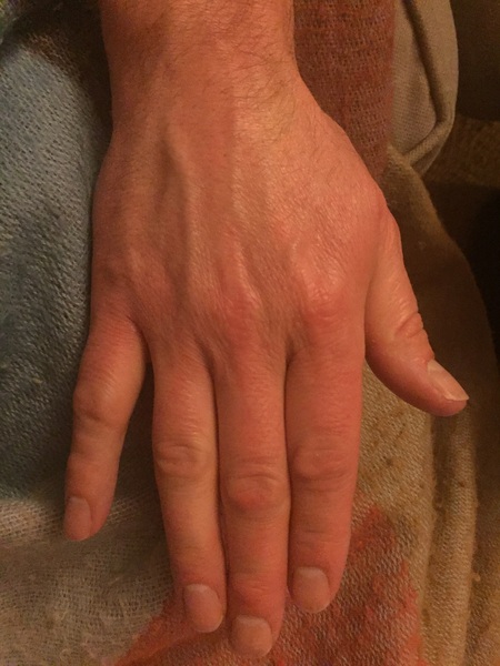 Guess the age of my hand.