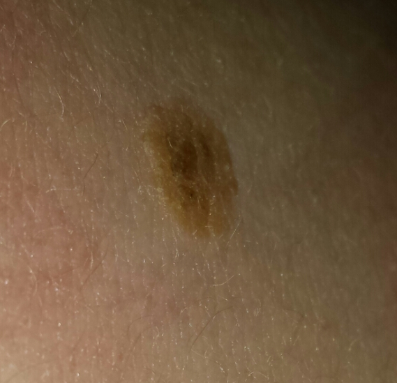 Anyone good with skin disorders?