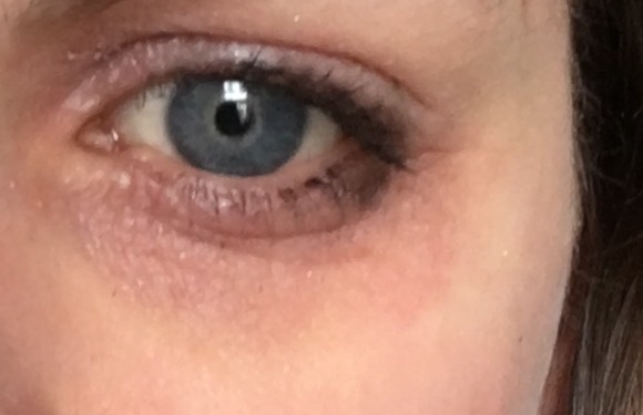 Help me hide this bruise