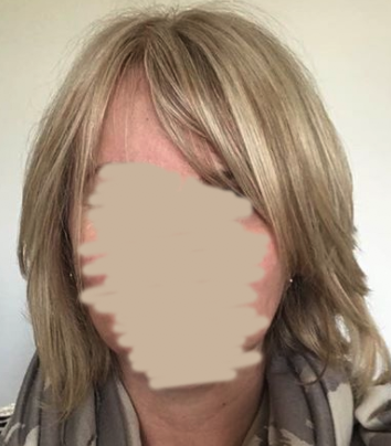 Hair opinions please (with pics)