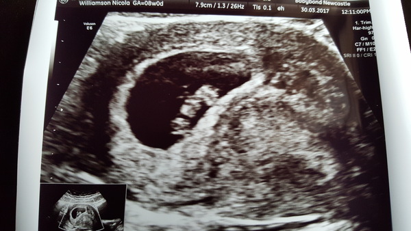 First Time Pregnancy