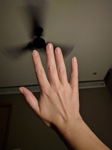 Guess the age of my hand.