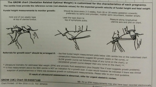 May 2017 #10 - To be prepared or not prepared