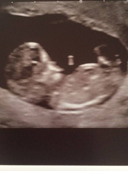 Just for fun baby sex guess