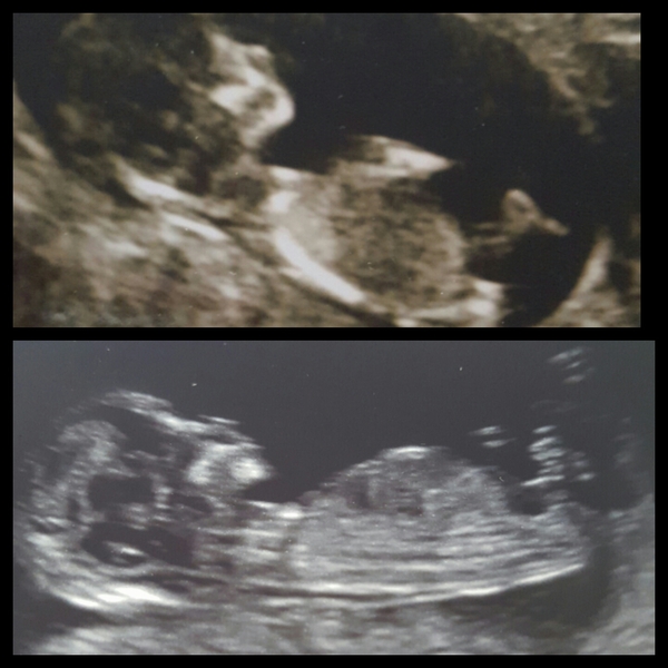 Anyone want to gender guess?