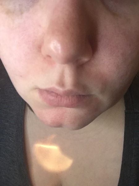 Ditch The Foundation, Embrace Some Fantastic Skincare Instead!