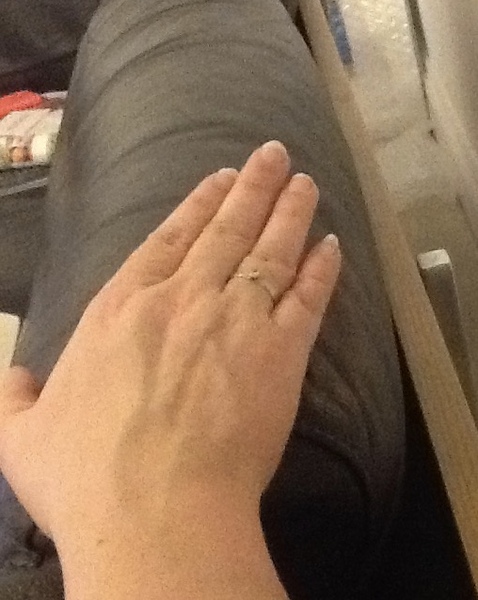 Guess the age of my hand.