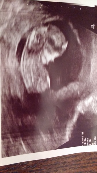 October Babies No. 3