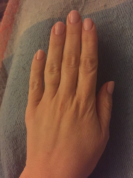 Guess the age of my hand.