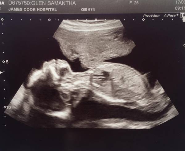 #TTC1 - Second Wave grads thread!