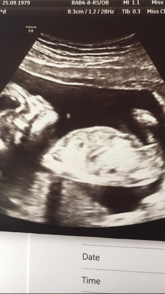 Due Sunday - gender suspense