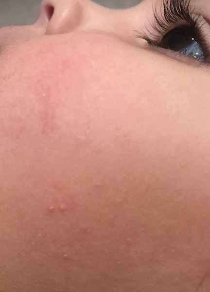 What is this on DC face?