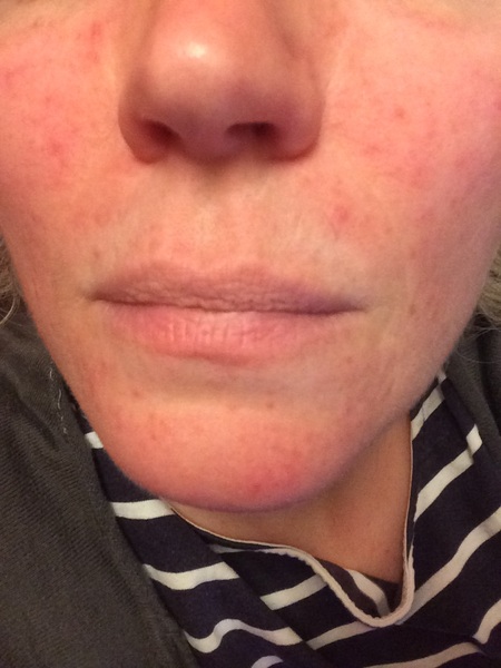 What the hell is going on with my skin?