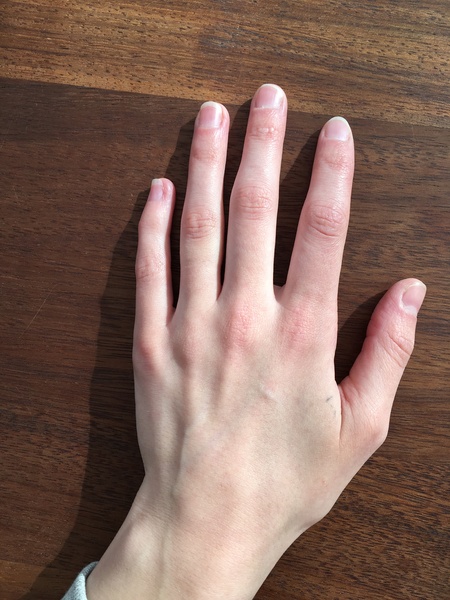 Guess the age of my hand.