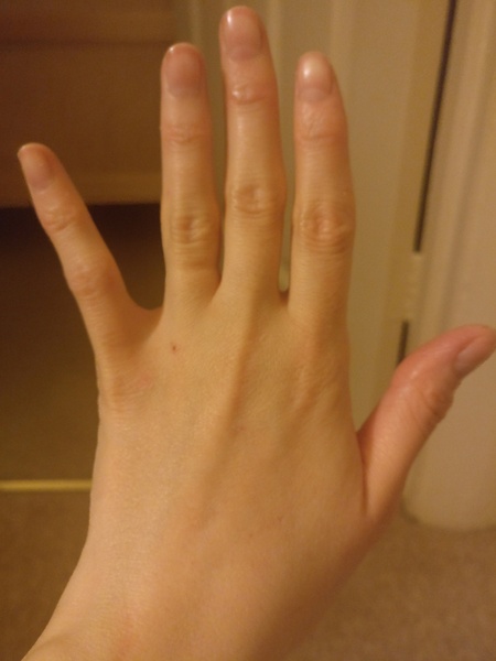 Guess the age of my hand.