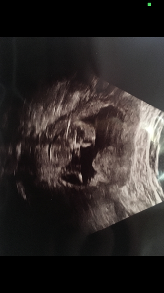Guesses at baby gender please!