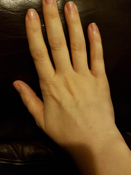 Guess the age of my hand.