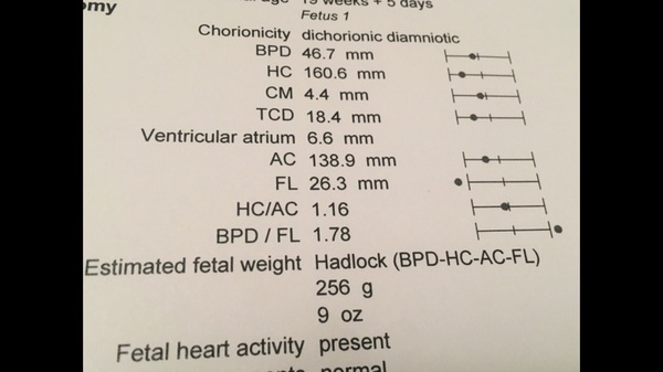 Expecting multiples 2017!