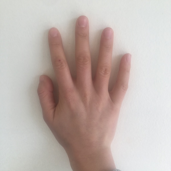 Guess the age of my hand.