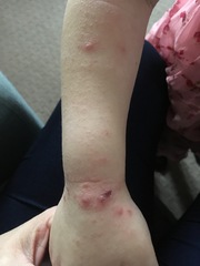 What are these spots? (Pics)