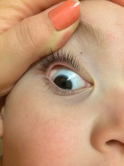 Toddler eyeball