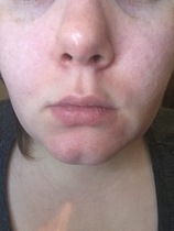 Ditch The Foundation, Embrace Some Fantastic Skincare Instead!