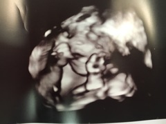 Due July 2017 #4 …… Well into 2nd Trimester! 20 Week Scans and Bumps Galore