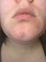 Ditch The Foundation, Embrace Some Fantastic Skincare Instead!