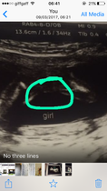 Private scan wrong ?