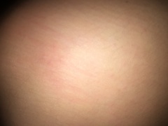 What are these bumps on my skin (pic)