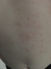What are these spots? (Pics)