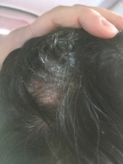 *klaxon* Sporn advice needed