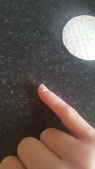 Klaxon - infected finger.