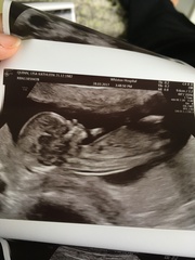 October Babies No. 3