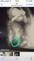 Private scan wrong ?
