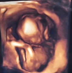 Due July 2017 #4 …… Well into 2nd Trimester! 20 Week Scans and Bumps Galore