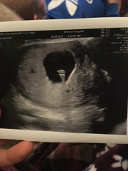 October Babies No. 3