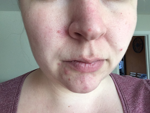How would you rescue this complexion?