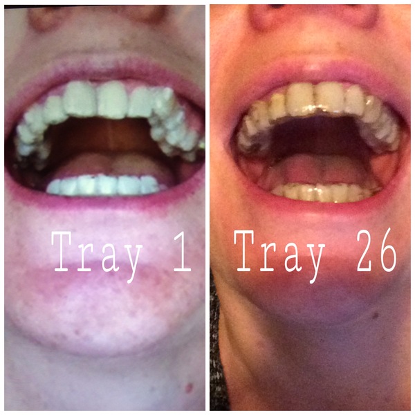 Dental Chronicles