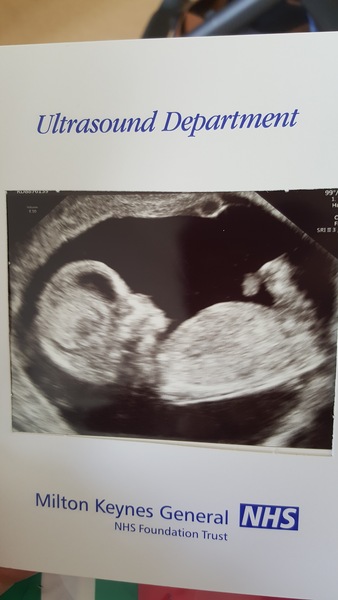 October Babies No. 3