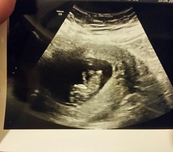 Just for fun.. second baby image in scan
