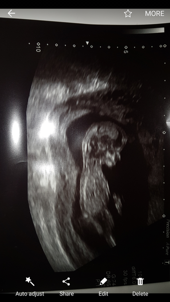 First Time Pregnancy (2)
